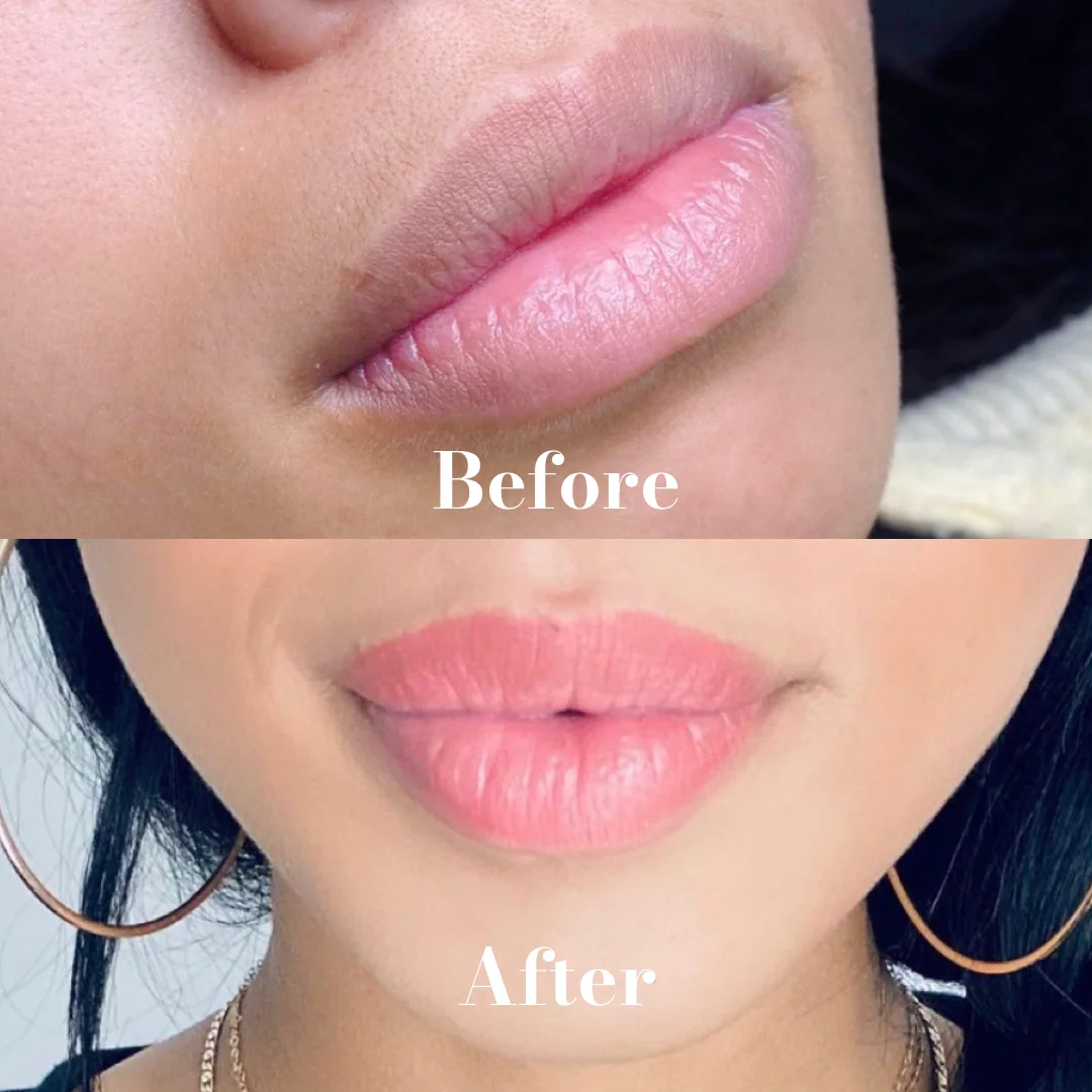 Lip blush treatment results